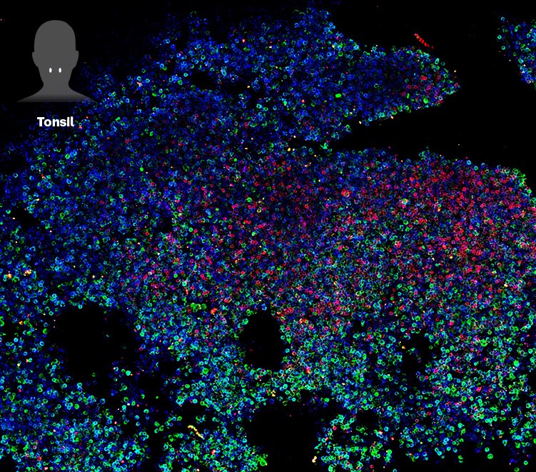 Fluorescence image of an organoid grown from human tonsil cells that shows where immune cells are nurtured.