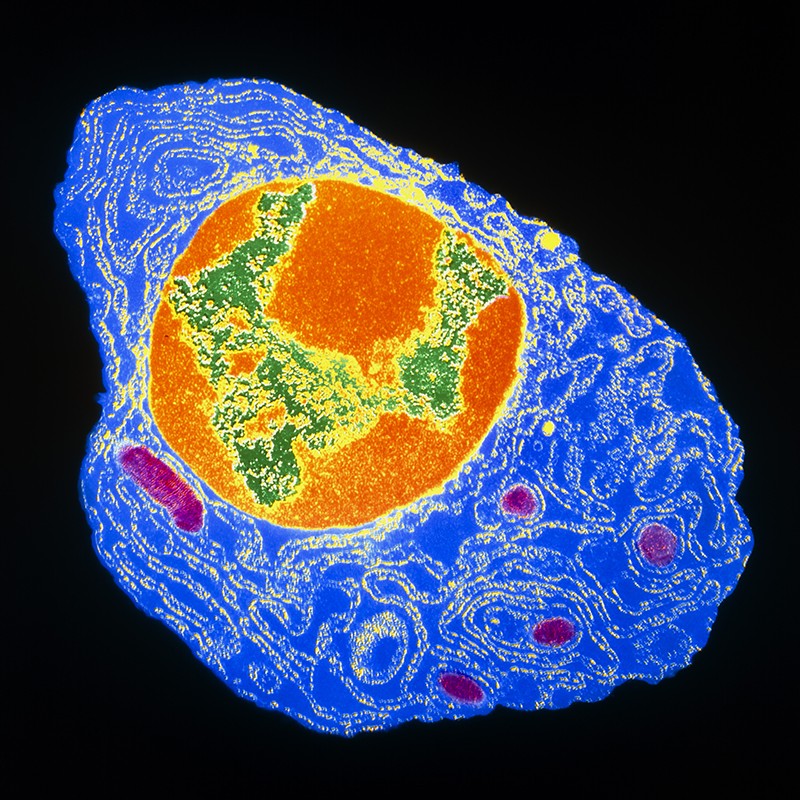 Coloured transmission electron micrograph of a plasma cell from bone marrow