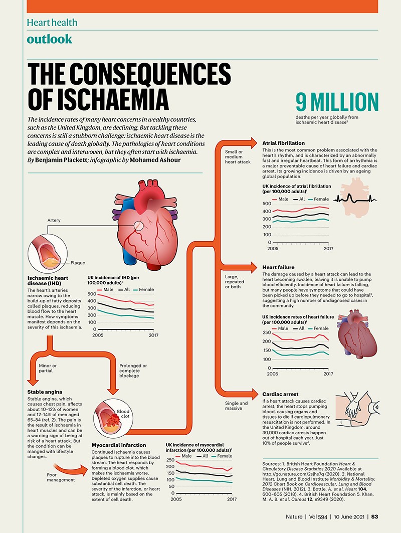 A Graphical Guide To Ischaemic Heart Disease 2112