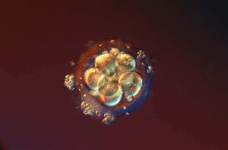 Light micrograph of a human morula embryo three to four days after fertilisation