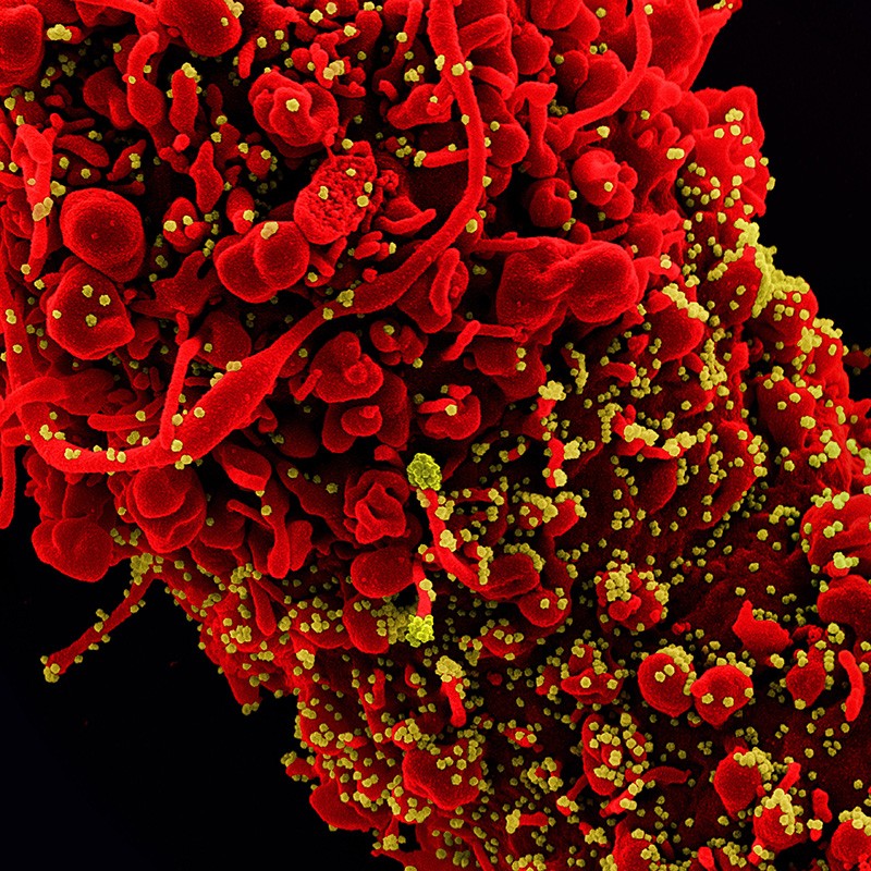 Colourized scanning electron micrograph of a cell (red) infected with SARS-COV-2 virus particles (yellow)