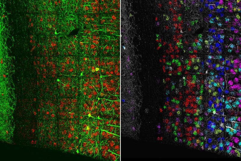 Micrographs of mouse brain neurons made using Expansion microscopy