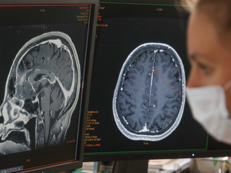 A person in a face mask looks at brain scans on two computer monitors.