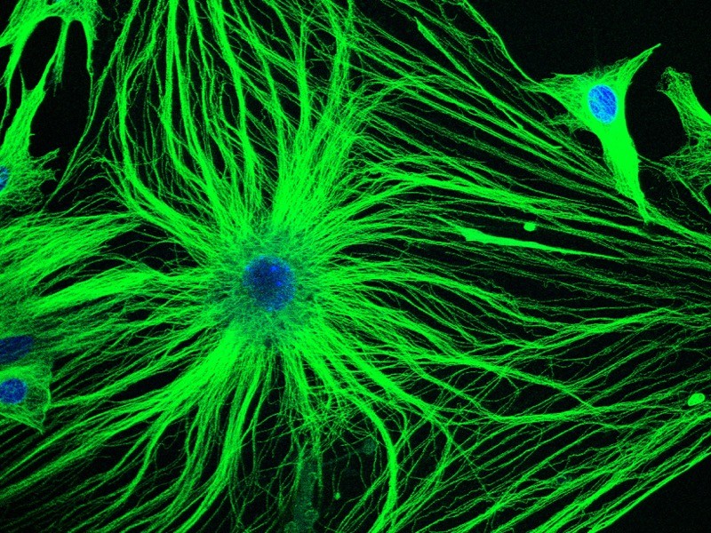 Micrographie à lumière confocale montrant des cellules vert vif avec de nombreuses frondes et des noyaux bleus.