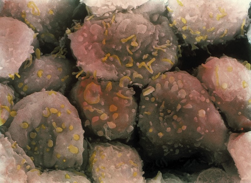 Coloured scanning electron micrograph (SEM) showing cells coloured pink and brown.
