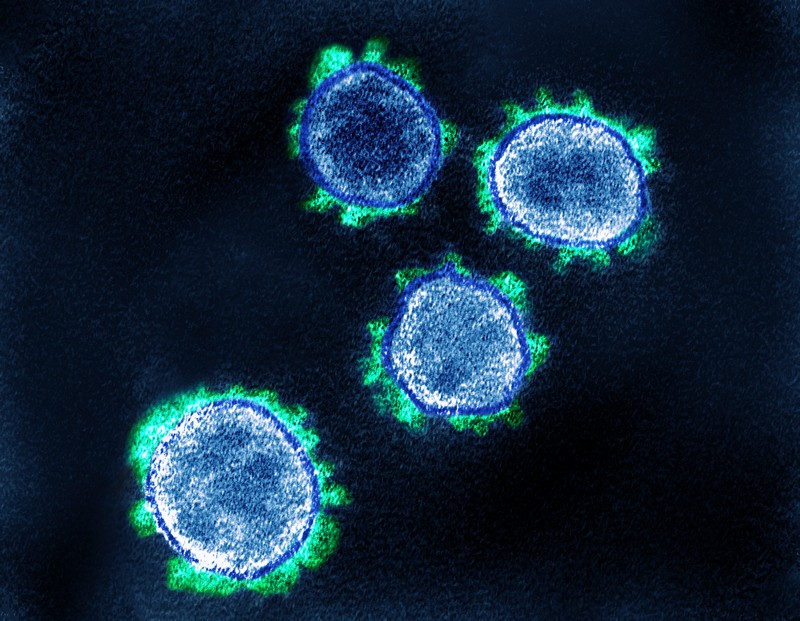 Coloured transmission electron micrograph of SARS-CoV-2 coronavirus particles