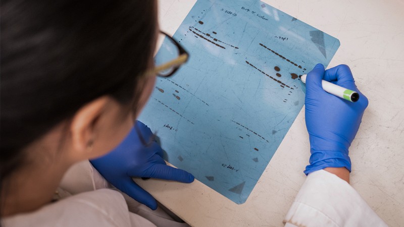 Ein Laborant, der einen weißen Kittel und Handschuhe trägt, hält einen Marker über die Ergebnisse der Gelelektrophorese.