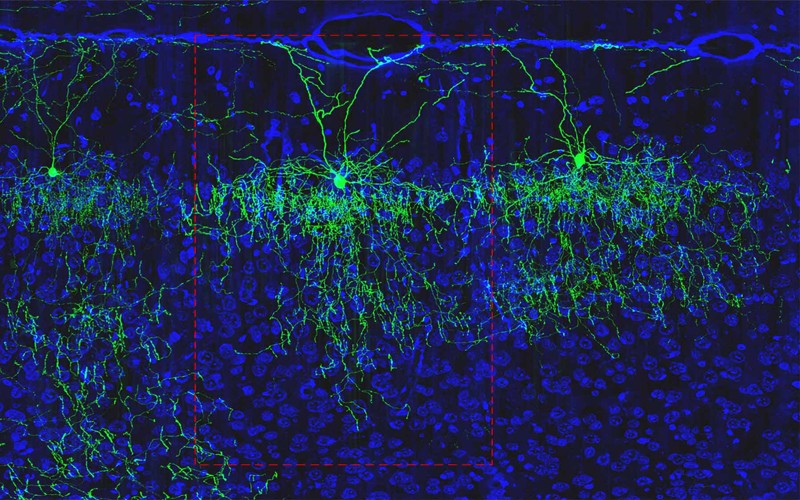 Axo-axonic cell found in the cortex of a mouse brain highlighted in green on a blue background