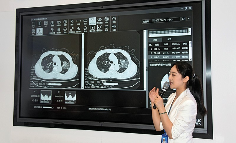 A researcher gives a talk standing in front of a screen displaying imaging scans from a patient