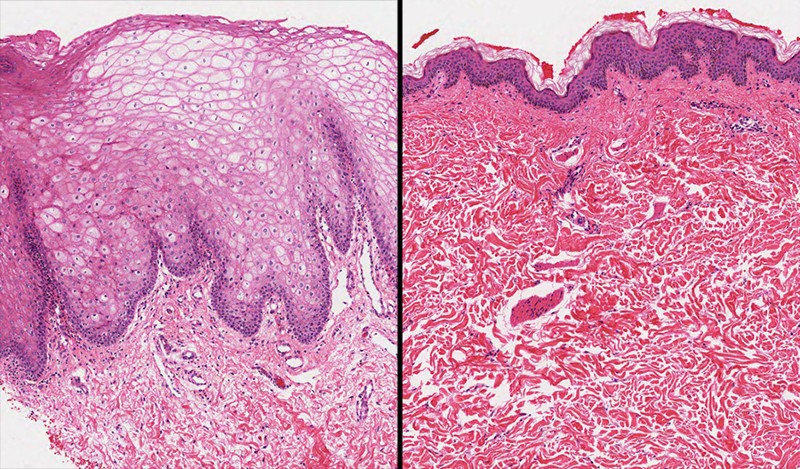 Comparison biopsy images - oral at left and underarm at right
