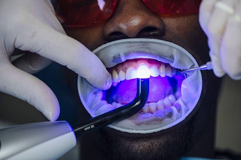 Close up of an open mouth with the teeth irradiated