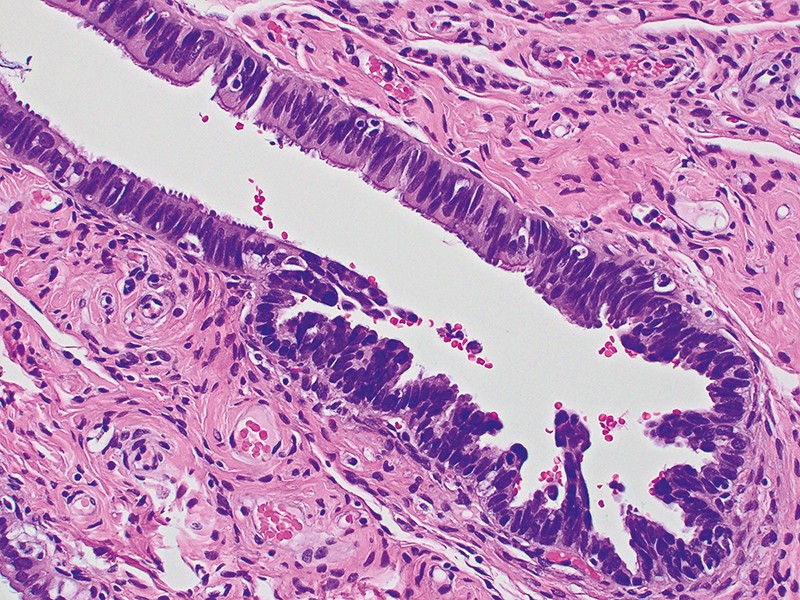 Micrograph of a fallopian tube