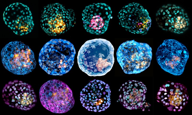 異なる細胞染色によるiBlastoidsの合成画像