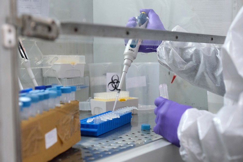 يستخدم فني قطارة أنبوبية لاستخراج الحمض النووي الريبي أثناء اختبار Covid-19 RT PCR في المختبر.
