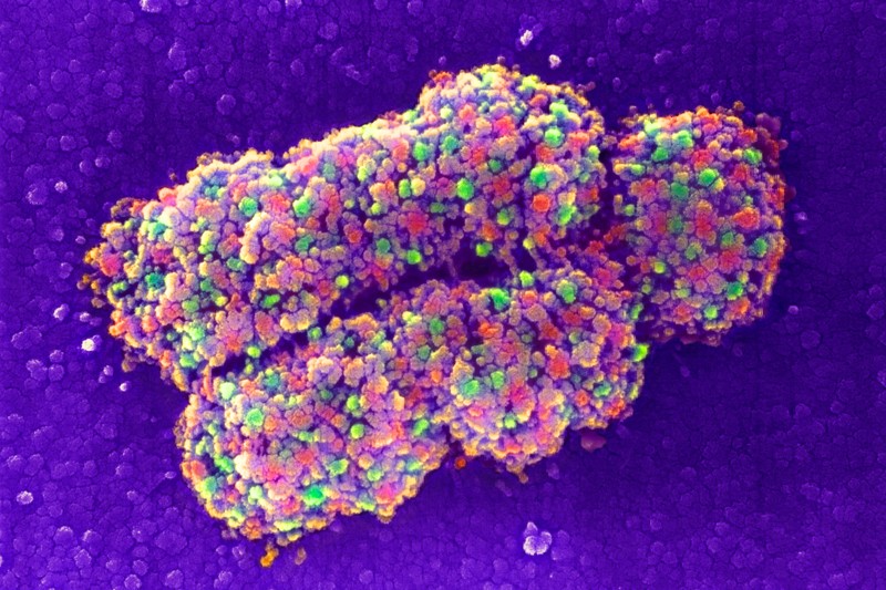 Coloured scanning electron micrograph of a chromosome