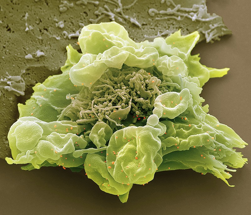 Coloured scanning electron micrograph (SEM) of COVID-19.
