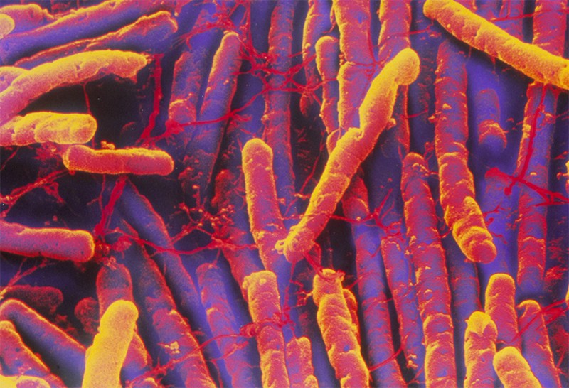A scanning Electron Micrograph showing Clostridioides difficile bacteria