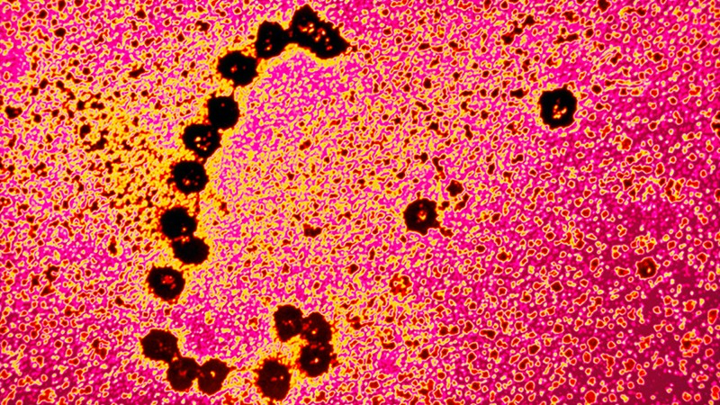 Цветен TEM на рибозоми, транслиращи MRNA верига.