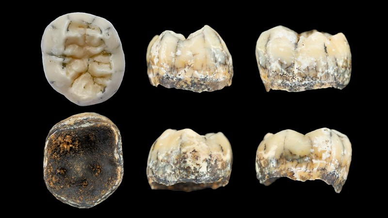 Multiple views of a child’s tooth unearthed in a cave in northern Laos may have belonged to a Denisovan girl.