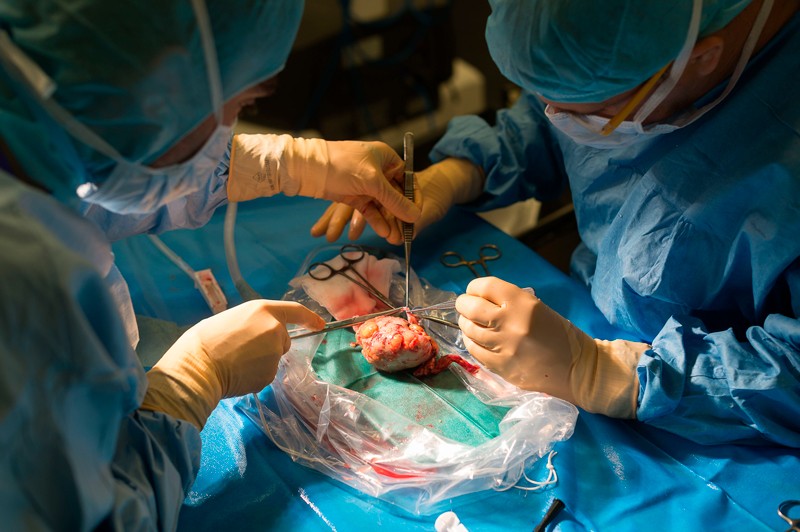 Two surgeons inspect a kidney that has just been removed from a donor for transplantation
