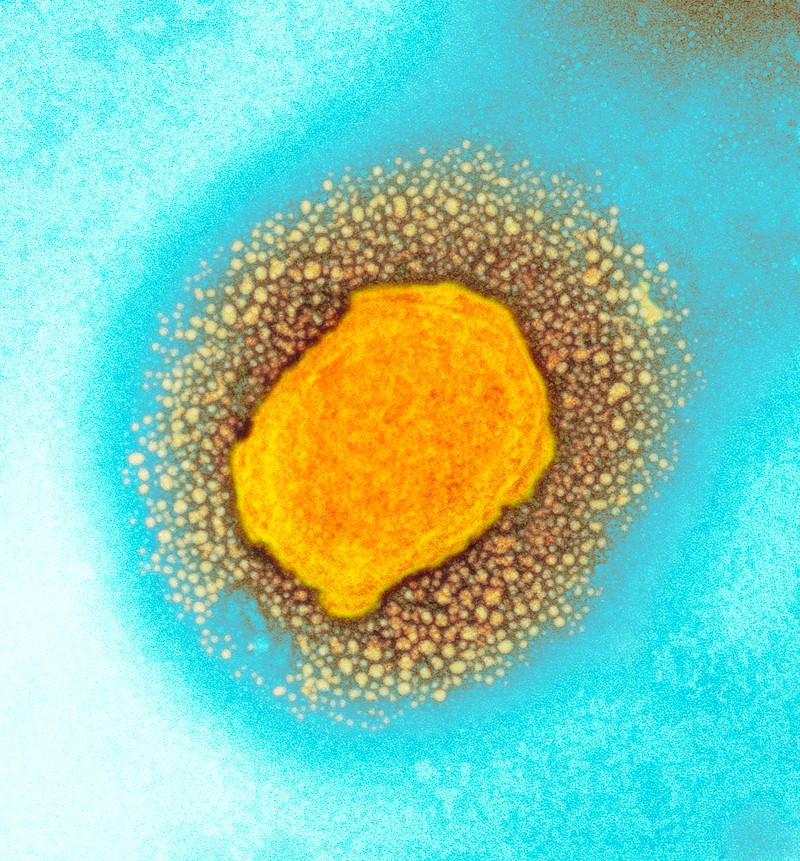Micrographie électronique à transmission colorée d'une particule de virus Monkeypox jaune sur fond bleu