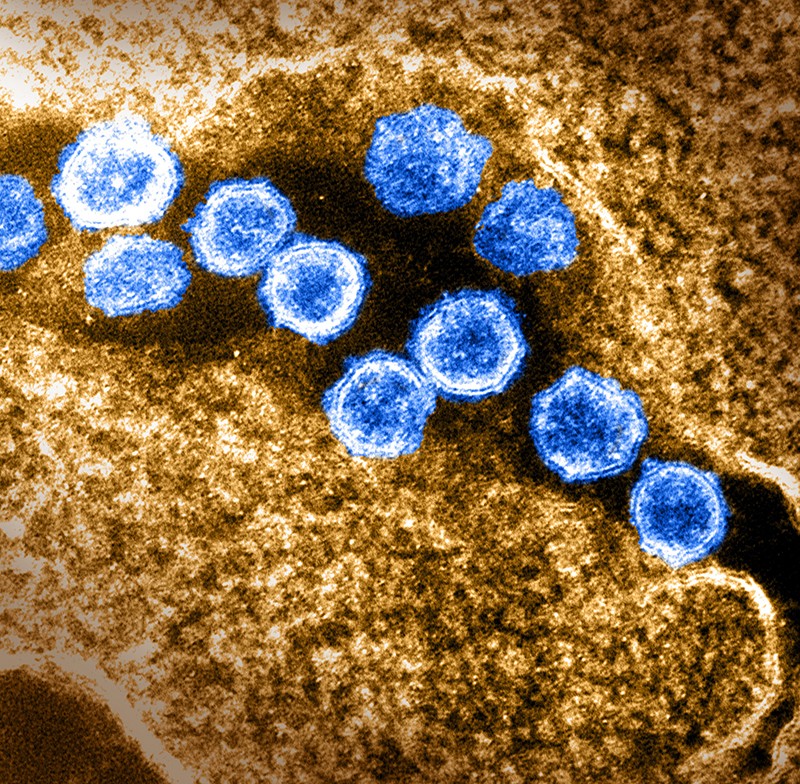 Colored transmission electron micrograph of SARS-CoV-2 coronavirus particles (blue) emerging from a cultured cell in the laboratory.