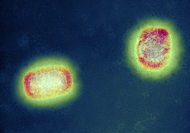 Monkeypox virus (MPV) particles, coloured transmission electron micrograph (TEM).