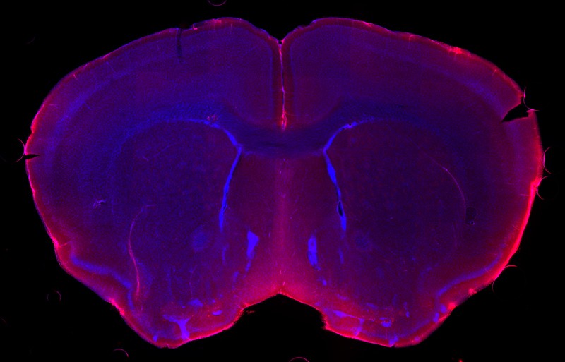 A micrograph of a mouse brain showing cerebrospinal fluid in red penetrating the brain parenchyma in blue