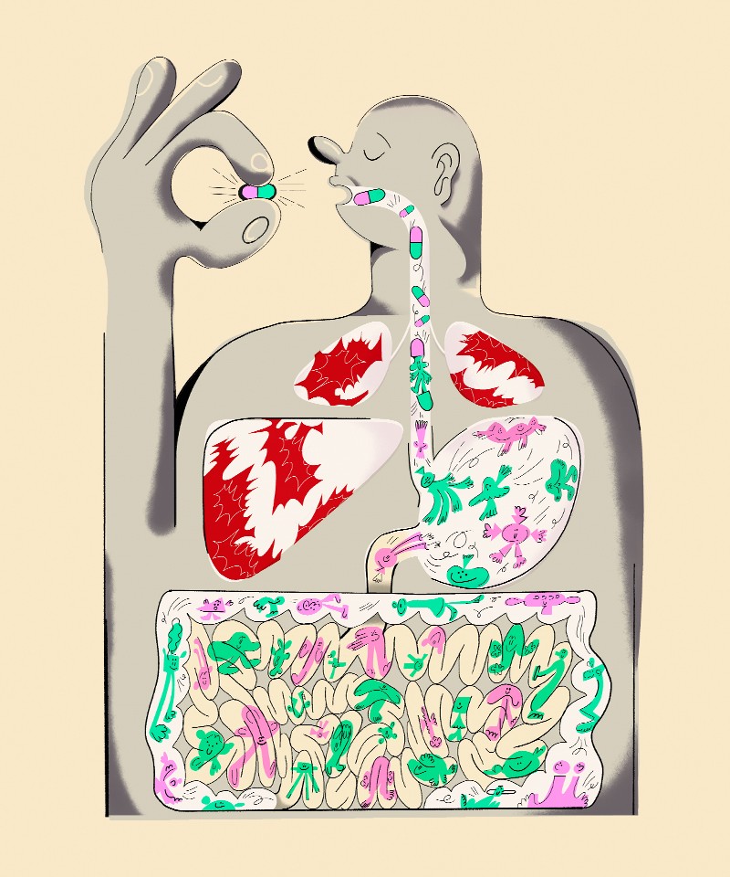 Conceptual illustration showing a cancer patient undergoing microbiome treatment.
