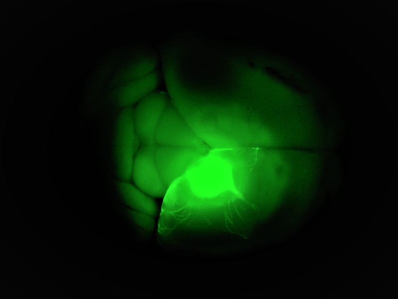 A human cortical organoid transplanted into a mouse brain