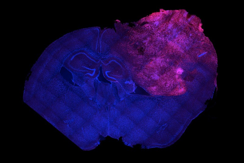Whole mouse brain with a human neural transplant