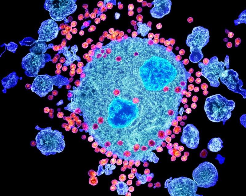 Coloured transmission electron micrograph of HIV particles budding from the surface of a T lymphocyte