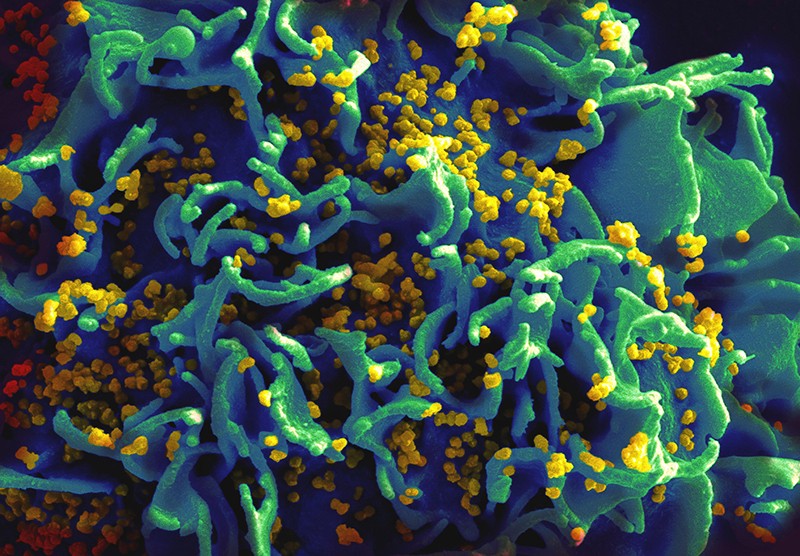 The Discovery Of Hiv 1