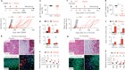 Melanomas resist T-cell therapy through inflammation-induced reversible dedifferentiation