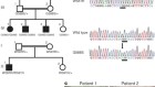 Lanosterol reverses protein aggregation in cataracts