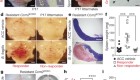Endothelial TLR4 and the microbiome drive cerebral cavernous malformations