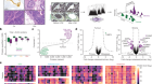 Proteomics reveals NNMT as a master metabolic regulator of cancer-associated fibroblasts