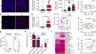 The fungal mycobiome promotes pancreatic oncogenesis via activation of MBL