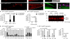 Extracellular proteostasis prevents aggregation during pathogenic attack