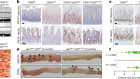 El microbioma intestinal cambia el p53 mutante de supresor tumoral a oncogénico