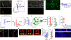 Gut-educated IgA plasma cells defend the meningeal venous sinuses