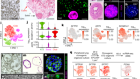 Progenitor identification and SARS-CoV-2 infection in human distal lung organoids