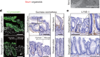 An organoid-based organ-repurposing approach to treat short bowel syndrome