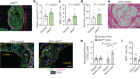 The AIM2 inflammasome exacerbates atherosclerosis in clonal haematopoiesis