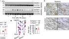 MARK4 controls ischaemic heart failure through microtubule detyrosination