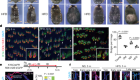 Obesity accelerates hair thinning by stem cell-centric converging mechanisms