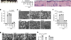 Streptococcal pyrogenic exotoxin B cleaves GSDMA and triggers pyroptosis