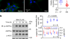 Low-dose metformin targets the lysosomal AMPK pathway through PEN2