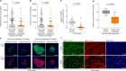 PHGDH heterogeneity potentiates cancer cell dissemination and metastasis