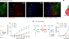 Targeting thalamic circuits rescues motor and mood deficits in PD mice